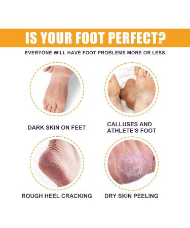 Yuci Banana & Honey-Milk Foot Balm - Repair Cracked Skin & Moisturize Dry Hands/Feet | Anti-Fungal Formula for Rough Skin - Buy Online on SooperMarket.com