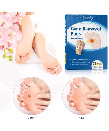 MQUPIN Corn Remover Pads Wart Remover Pads Foot Corn Remover Pads Plantar Wart Removal Corn Callus Remover Penetrates and Removes Common and Plantar Warts with Hole Callus Stops Wart Regrowth (24 PCS) - Buy Online on SooperMarket.com