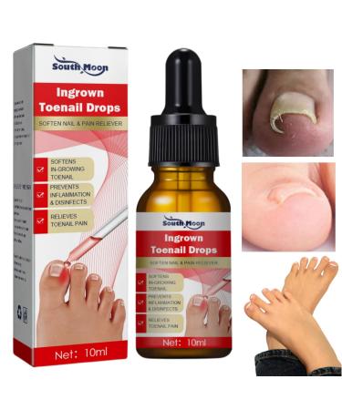 Ingrown Toenail Treatment Treatment for Ingrown Toenail Anti Paronychia Relief Oil Nail Growth Treatment for Ingrown Toenail Fungal Toenail Treatment Nail Repair Treatment for Ingrowing Toenail