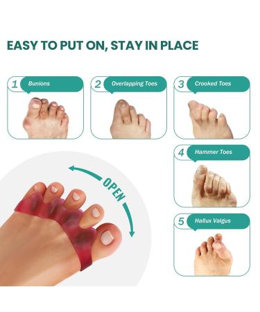 Welnove 8-Pack Toe Separator to Correct Bunions and Restore Toes to Their Original Shape Bunion Corrector for Women Men Toe Spacers for Gifts (Deep Red) - Buy Online on SooperMarket.com