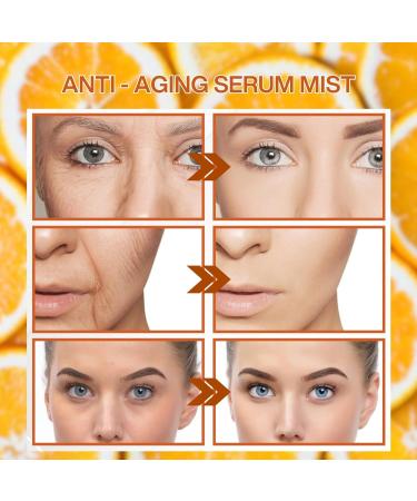 Vitamin C Face Mist Vitamin C Serum Spray For Face Anti Aging Face Spray Face Serum Lifting & Firming Mask And Spray Hydrating Mist Deeply Moisturizing & Skin Brightening Spray - Buy Online on SooperMarket.com