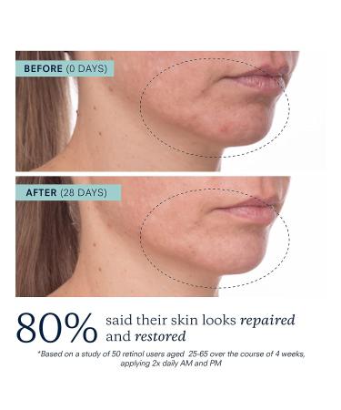 KORA Organics Plant Stem Cell Retinol Alternative Serum - Certified Organic Plant Based Formula for Aging Skin Repair and Radiance - 0.34 fl oz - Cruelty Free - Buy Online on SooperMarket.com