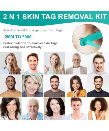 Skin Tag Remover 2 in 1 Kit for Medium/Large Skin Tags - Painless Mole Wart Treatment Tool for Face and Body - Buy Online on SooperMarket.com