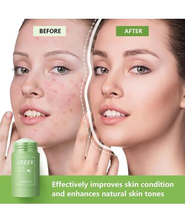 Anguishil Green Tea Mask Stick - Deep Cleanse & Oil Control for All Skin Types (1 PCS) - Buy Online on SooperMarket.com