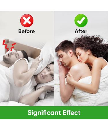 Nasal Strips 100Pcs Nasal Strips for Snoring Stop Snoring and Breathing Smoothly Instant Nasal Congestion on Relief for Improve Sleep Quality - Buy Online on SooperMarket.com
