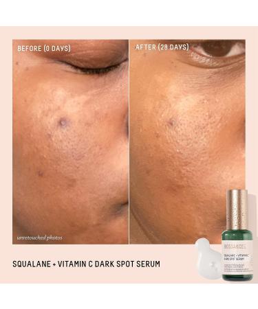 Biossance Squalane + Vitamin C Dark Spot Serum - 10% Vitamin C for Brightening, Dark Spot Reduction, and Pigmentation Control (1.01 oz) - Buy Online on SooperMarket.com