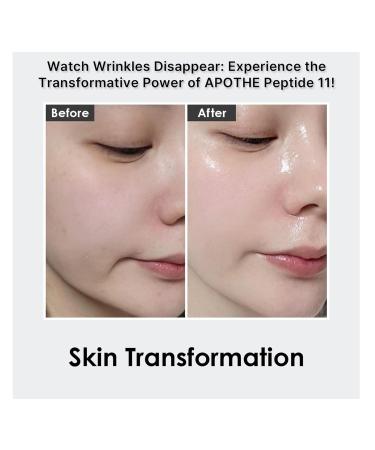 Buy Tulip Barrier Vegan Ampoule 30ml - Best Vegan Skincare for Global Shipping - Buy Online on SooperMarket.com