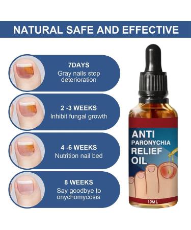 Ingrown Toenail Treatment Correction Drops Nail Growth Treatment Nail Care Ingrowing Toenail Treatment Ingrown Toenail Corrector Treatment for Ingrown Toenail Ingrowing Toenail Improve Toenail Health - Buy Online on SooperMarket.com