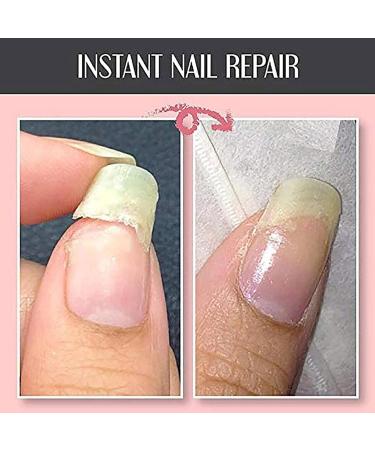 10ml Nail Repair Protection Gel Mottled Nail Repair Protection Gel Mottled Gel Nail Repair Instant Repair Gel Nail - Buy Online on SooperMarket.com