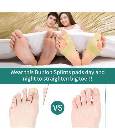 DYKOOK Bunion Corrector & Big Toe Straightener with Heel Strap for Pain Relief - 1 Pair Split Toe Separator for Hallux Valgus Corrector - Non-slip Bunion Protector - Beige (Small) - Buy Online on SooperMarket.com
