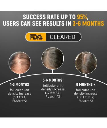 Laser Comb Hair Growth Device Medical Grade Lasers FDA Cleared Hair Loss Treatment for Men and Women with Thinning Hair Rechargeable Hair Growth Product Black - Buy Online on SooperMarket.com