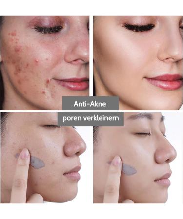 Face Mask - Dead Sea Mask - Clay Mask Face for Cleans Acne and Dark Spots Pores Reducing Face Masks Beauty 250 g - Buy Online on SooperMarket.com