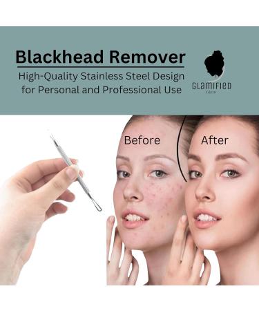 Glamified Blackhead Remover Professional Skincare Spot Treatment Blackhead Remover Tool for Blemish Comedone Whiteheads Pimple Popper with Double Sided Soft Touch and Anti-Slip Design - Buy Online on SooperMarket.com