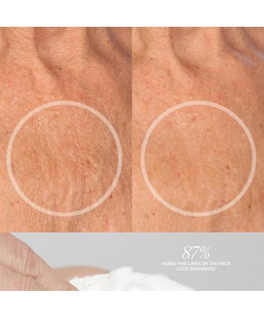SiO Cryo Neck & D collet Cream | Firming & Smoothing Treatment for Youthful Skin - Shop Internationally - Buy Online on SooperMarket.com