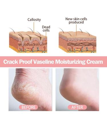 Cracked Heel Repair Cream Stick Foot Moisturizing Stick Foot Cream For Very Dry Feet Foot Cream For Calluses And Hard Skin Foot Moisturiser Callus Remover Soften For Feet Knees Hand - Buy Online on SooperMarket.com