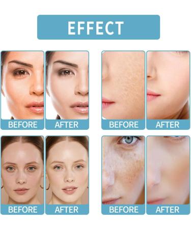 Nmbol Skin Lightening Serum B5 Spot Correction Serum B5 Corrector Serum Pigment Spot Remover Serum B5 Against Pigment Spots Wrinkle Reduction and Adolescent Radiation - Buy Online on SooperMarket.com