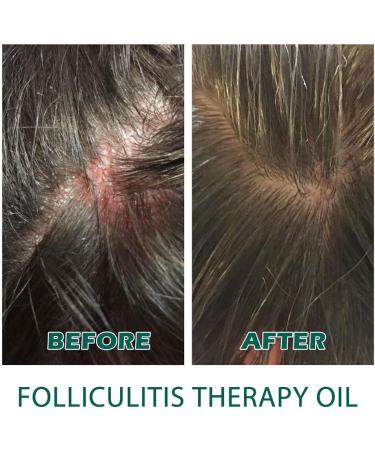 FIOERDTUIE Adults Hair Growth Essential Oil Follicle Repair Moisturizing Nourishing Essence Haircare Serum Beauty Supplies - Buy Online on SooperMarket.com