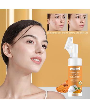 Shop Turmeric Face Wash - Acne Cleanser Kojic Acid Foaming Facial Cleanser for Women | 5.28 FLOZ - Buy Online on SooperMarket.com