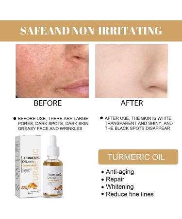 2022 Turmeric Dark Spot Corrector Serum for Face - Natural Skin Care Moisturizing Serum (2PCS-60ml) - Buy Online on SooperMarket.com