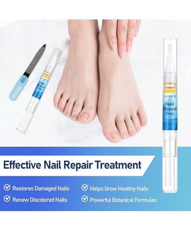 XIFEPFR Toenail Repair Pen - Nail Fingernail Repair Pen for Thick  Broken  Discolored Nails - Restores Healthy Strong Nails - 4PCS - Buy Online on SooperMarket.com