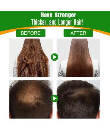 Buy 100% Pure Batana Oil for Hair Growth - Natural & Raw for Thicker Stronger Hair | 2.02 FL OZ | Ships Internationally - Buy Online on SooperMarket.com