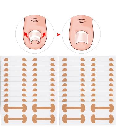 Ingrown Toenail Correction Sticker Adhesive Paronychia Straightening Patch Nail Corrector Bandage Easy Operation and Quality Material 20 Sheets for Foot Care - Buy Online on SooperMarket.com