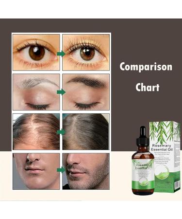 Rosemary Essential Oil for Hair Growth | Natural Hair Loss Solution & Aromatherapy - 60ml - Buy Online on SooperMarket.com