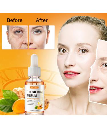 Turmeric Dark Spot Corrector Serum 2 PCS - Natural Facial Serum for Hyperpigmentation, Age & Sun Spots - Moisturizing Essence for Women & Men - 1Fl Oz (Pack of 2) - Buy Online on SooperMarket.com