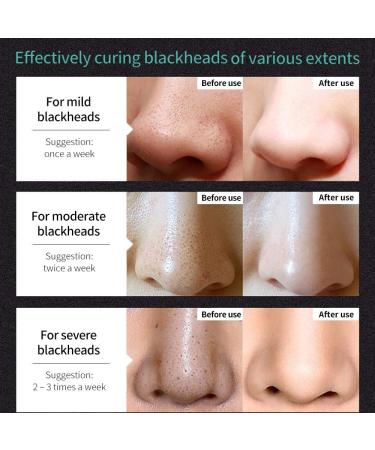 Blackhead Removal Peel Off Mask - Purifying Bamboo Charcoal Facial Mask for Deep Pore Cleansing & Skin Brightening - Suitable for All Skin Types - Buy Online on SooperMarket.com