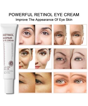 Retinol Eye Cream & 24k Under Eye Patches Kit - Anti-Aging Dark Circles & Puffy Eyes Treatment - Moisturizing & Firming Formula - Buy Online on SooperMarket.com