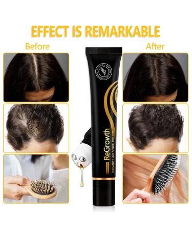 Hair Growth Serum for Men & Women | Boost Hair Growth Treat Hair Loss & Achieve Full Hair - 20ml - Buy Online on SooperMarket.com