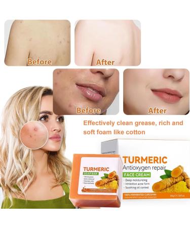Turmeric Soap Turmeric Brightening Soap Kojic Acid Soap Turmeric Soap Bar Turmeric Soap Bar for Deep Cleansing Women's Men's Soap Bar for Face & Body with A Foaming Net (100g) - Buy Online on SooperMarket.com