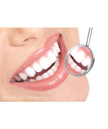 Handheld LED Teeth Whitening Accelerator - Portable Dental Light Device - Buy Online on SooperMarket.com