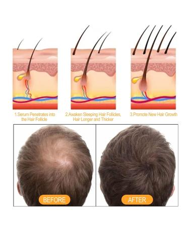 500ml Ginger Hair Regrowth Shampoo for Thickening & Anti-Hair Loss - 2 Pack - Buy Online on SooperMarket.com