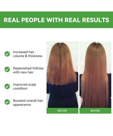 Rosemary Hair Growth Oil & Serum - Dry Scalp Treatment for Women | Hair Thickening & Essential Oil (2OZ) - Boost Hair Growth & Combat Hair Loss - Buy Online on SooperMarket.com