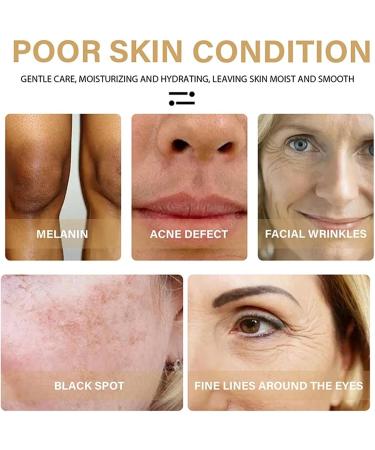 Turmeric face seruem Dark Spot Remover Essence Turmeric Serums for face Brightens Skin Tone Moisturizes Hydrates Lightens Age-Spots Acne Reduce Fine Lines Facial Care Anti-Aging Serum - Buy Online on SooperMarket.com