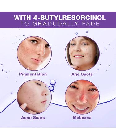 Dark Spot Remover Serum for Face & Body | Age Sun Spots, Freckles, Melasma Treatment | 4-Butylresorcinol, Kojic Acid, Hyaluronic Acid - 50ml - Buy Online on SooperMarket.com