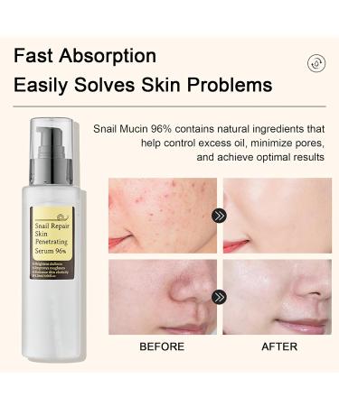 Advanced Snail Mucin 96% Power Repairing Essence | Hydrating Anti-Aging Face Serum for All Skin Types - Buy Online on SooperMarket.com