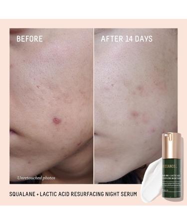 Biossance Squalane + Lactic Acid Resurfacing Night Serum - 1 Fl Oz | Exfoliating AHA for Smoother Skin, Diminishes Fine Lines, Brightens Complexion - Buy Online on SooperMarket.com