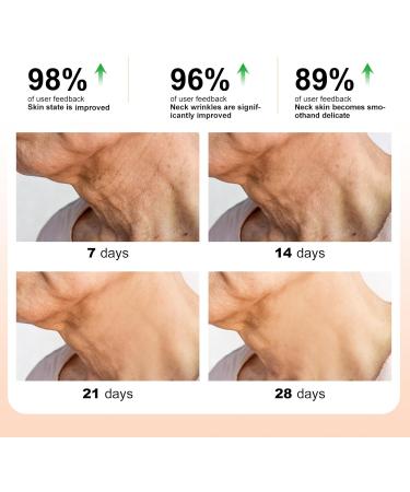 Retinol Neck Firming Cream Anti Wrinkle Neck Cream Tighten and Lift Neck Cream Black Neck Remover Vitamin E Hydrating Lifting and Smoothing Sagging Skin Night Cream for Women - Buy Online on SooperMarket.com