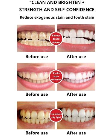 2PC SP-6 Ultra Whitening Toothpaste Probiotic Teeth Lightening Formula for Brilliant Smiles | International Shipping Available - Buy Online on SooperMarket.com