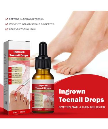 Ingrown Toenail Treatment Nail Growth Ingrowing Toenail Treatment Nail Helper Fungal Nail Treatment Correction Oil Drops Ingrown Toenail Corrector Toe Nail Fungus Treatment Cuticle Oil - Buy Online on SooperMarket.com