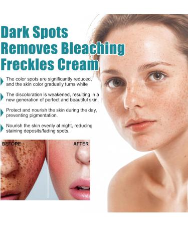 Fade Stain Beauty Cream Freckle Remover Cream Dark Spot Remover for Face Age Spot Remover Corrector Cream for Face and Body Dark Spot Remover Dark Spot Remover for Face and Body - Buy Online on SooperMarket.com