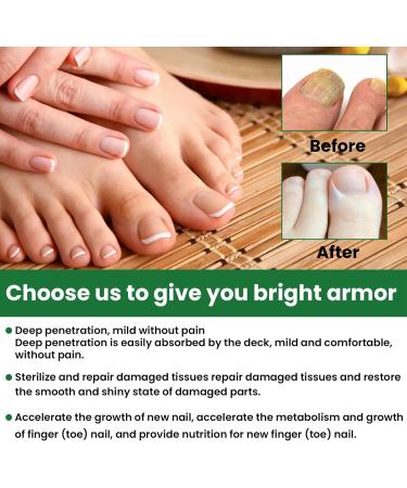 MrCuvaryas Nail Serum for Toenails Extra Strong - Buy Online on SooperMarket.com