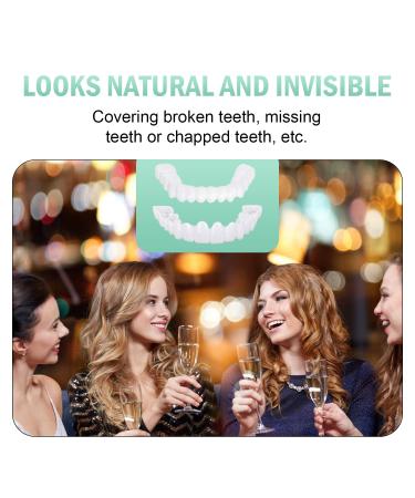 2 PCS Veneers Dentures Socket for Women and Men - Temporary Tooth Repair | Bright White Dental Veneers for Upper and Lower Jaw - Protect & Restore Your Smile - Buy Online on SooperMarket.com