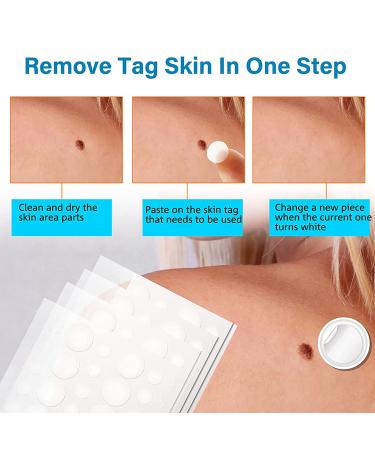 Skin Tag Remover Patches - 144Pcs | Safe & Painless Wart Removal for Face & Body - Buy Online on SooperMarket.com