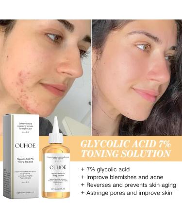 Glycolic Acid 7% Toning Solution Glycolic Acid Toner Hydrating Toner Glycolic Acid Serum Improve Blemishes&Acne and Spots Anti Aging Exfoliating Toner for Face Toner for Oily Skin 100ml - Buy Online on SooperMarket.com