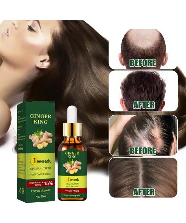 Ginger Oil Hair Growth Natural Hair Density Essential Oil Skin 100% Pure Essential Oil Aromatherapy Repair Skin Hair Growth Oil Strengthens Hair (Ginger 30 ml) B - Buy Online on SooperMarket.com