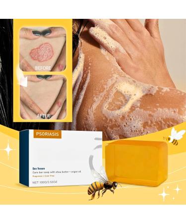 Bee Venom Soap Bee Venom Moisturing Soap Bars - Natural Soap Bar with Shea Butter & Argan Oil Bee Venom Psoriasis Soap Organic Soap - Body Soap Bars Shower Soap - Deep Cleanse Bar Soap for Skin - Buy Online on SooperMarket.com