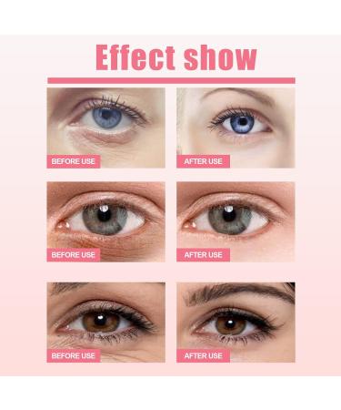 Hyaluronic Eye Cream Stick Caffeine Relax Eyes Fatigue Eye Cream Anti Aging Reduce Under The Eyes Puffiness Rosehip Firming Eye Serum Eye Lift For Women And Men - Buy Online on SooperMarket.com